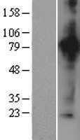 Aconitase 2(ACO2) (NM_001098) Human Tagged ORF Clone