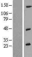 IL26 (NM_018402) Human Tagged ORF Clone
