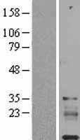 IGFL1 (NM_198541) Human Tagged ORF Clone
