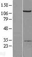 AP2B1(AP2B1) (NM_001030006) Human Tagged ORF Clone