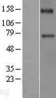 Factor XI(F11) (NM_000128) Human Tagged ORF Clone