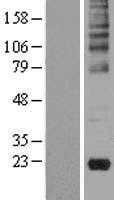 Gastrokine 2(GKN2) (NM_182536) Human Tagged ORF Clone