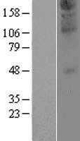 ZDHHC21 (NM_178566) Human Tagged ORF Clone