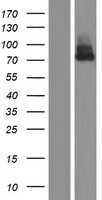 Growth hormone receptor(GHR) (NM_000163) Human Tagged ORF Clone