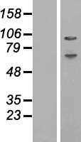 ABCF1 (NM_001025091) Human Tagged ORF Clone
