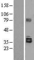 Stanniocalcin 2(STC2) (NM_003714) Human Tagged ORF Clone