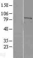 Factor XIIIa(F13A1) (NM_000129) Human Tagged ORF Clone