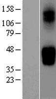 GLUT9(SLC2A9) (NM_020041) Human Tagged ORF Clone