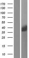 Galectin 8(LGALS8) (NM_006499) Human Tagged ORF Clone
