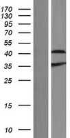 Aprataxin(APTX) (NM_001195250) Human Tagged ORF Clone