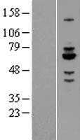 Rabex5(RABGEF1) (NM_014504) Human Tagged ORF Clone
