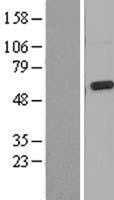 Mucolipin 3(MCOLN3) (NM_018298) Human Tagged ORF Clone