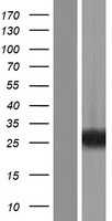 RAB39(RAB39A) (NM_017516) Human Tagged ORF Clone
