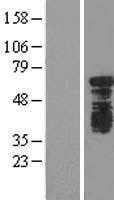 YTHDF1 (NM_017798) Human Tagged ORF Clone