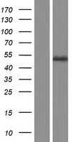 LMX1B (NM_002316) Human Tagged ORF Clone
