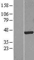 FOXF1 (NM_001451) Human Tagged ORF Clone