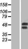 GM CSF Receptor alpha(CSF2RA) (NM_006140) Human Tagged ORF Clone