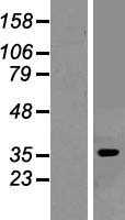Adenosine A1 Receptor(ADORA1) (NM_001048230) Human Tagged ORF Clone