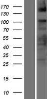 ASXL2 (NM_018263) Human Tagged ORF Clone