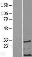 ZDHHC4 (NM_018106) Human Tagged ORF Clone