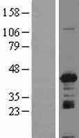 IGBP1 (NM_001551) Human Tagged ORF Clone