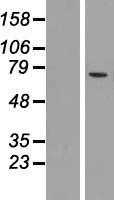 MCOLN2 (NM_153259) Human Tagged ORF Clone
