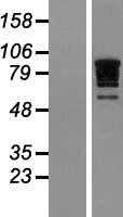 RBM10 (NM_152856) Human Tagged ORF Clone