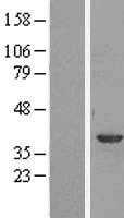 Annexin A1(ANXA1) (NM_000700) Human Tagged ORF Clone