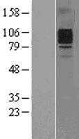 GCSF Receptor(CSF3R) (NM_000760) Human Tagged ORF Clone