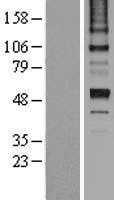 Antithrombin III(SERPINC1) (NM_000488) Human Tagged ORF Clone