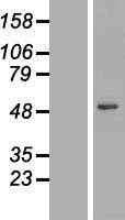 Lysosomal acid lipase(LIPA) (NM_000235) Human Tagged ORF Clone