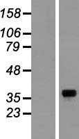GNB1 (NM_002074) Human Tagged ORF Clone