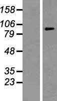 ATP6V0A1 (NM_005177) Human Tagged ORF Clone