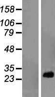 RPL10A (NM_007104) Human Tagged ORF Clone