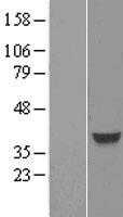FOXH1 (NM_003923) Human Tagged ORF Clone