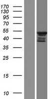 Repulsive Guidance Molecule A(RGMA) (NM_001166283) Human Tagged ORF Clone
