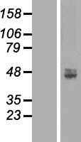 ACP6 (NM_016361) Human Tagged ORF Clone