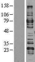 ARHGAP25 (NM_014882) Human Tagged ORF Clone
