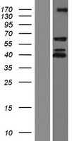 IGF2BP1 (NM_001160423) Human Tagged ORF Clone