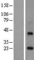 RAB3C (NM_138453) Human Tagged ORF Clone