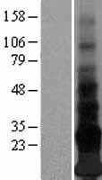 Adropin(ENHO) (NM_198573) Human Tagged ORF Clone