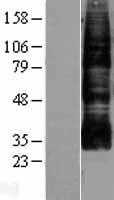 Aquaporin 9(AQP9) (NM_020980) Human Tagged ORF Clone