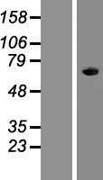A1CF (NM_138932) Human Tagged ORF Clone