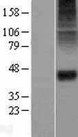 alpha 1 Glycine Receptor(GLRA1) (NM_000171) Human Tagged ORF Clone