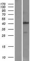 Aminomethyltransferase(AMT) (NM_000481) Human Tagged ORF Clone