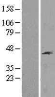 IL12RB1 (NM_153701) Human Tagged ORF Clone
