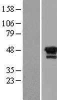 LIM1(LHX1) (NM_005568) Human Tagged ORF Clone