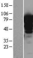 LMOD1 (NM_012134) Human Tagged ORF Clone