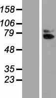 IL18R Beta(IL18RAP) (NM_003853) Human Tagged ORF Clone