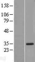 IL18BP (NM_173042) Human Tagged ORF Clone